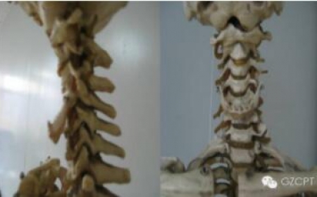 骨科评估—颈椎（口袋系列）